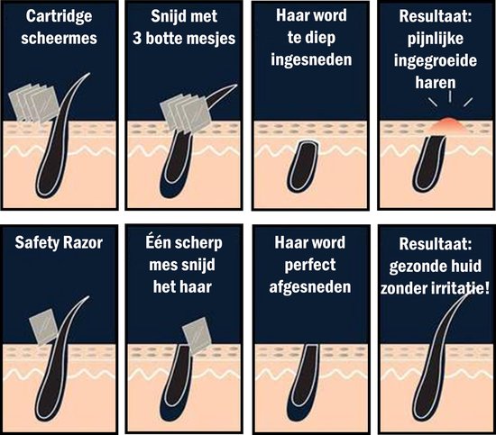 Safety razor QSHAVE + 5 titanium scheermesjes – dubbelzijdig scheermes voor mannen en vrouwen – klassiek scheermes